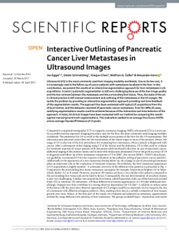 Interactive Outlining of Pancreatic Cancer Liver Metastases in
  Ultrasound Images