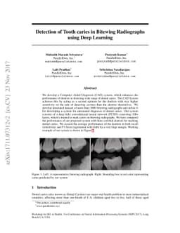 Detection of Tooth caries in Bitewing Radiographs using Deep Learning