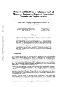 Delineation of Skin Strata in Reflectance Confocal Microscopy Images
  using Recurrent Convolutional Networks with Toeplitz Attention