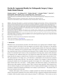 On-the-fly Augmented Reality for Orthopaedic Surgery Using a Multi-Modal
  Fiducial