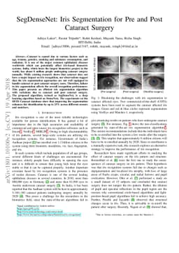 SegDenseNet: Iris Segmentation for Pre and Post Cataract Surgery