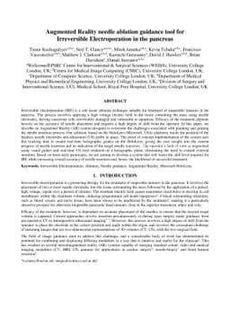 Augmented Reality needle ablation guidance tool for Irreversible
  Electroporation in the pancreas