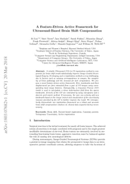 A Feature-Driven Active Framework for Ultrasound-Based Brain Shift
  Compensation