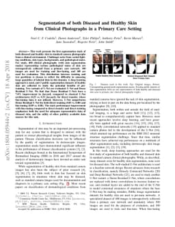 Segmentation of both Diseased and Healthy Skin from Clinical Photographs
  in a Primary Care Setting