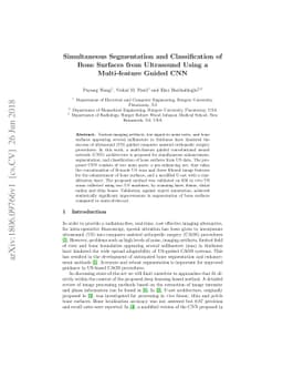 Simultaneous Segmentation and Classification of Bone Surfaces from
  Ultrasound Using a Multi-feature Guided CNN