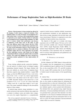 Performance of Image Registration Tools on High-Resolution 3D Brain
  Images