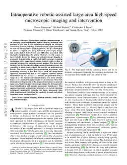 Intraoperative robotic-assisted large-area high-speed microscopic
  imaging and intervention