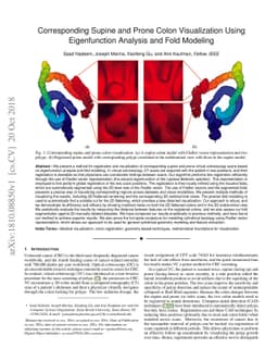 Corresponding Supine and Prone Colon Visualization Using Eigenfunction
  Analysis and Fold Modeling