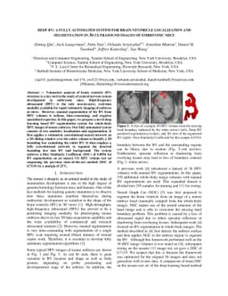 Deep BV: A Fully Automated System for Brain Ventricle Localization and
  Segmentation in 3D Ultrasound Images of Embryonic Mice