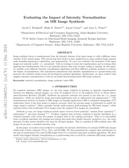 Evaluating the Impact of Intensity Normalization on MR Image Synthesis