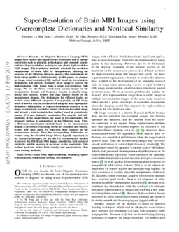 Super-Resolution of Brain MRI Images using Overcomplete Dictionaries and
  Nonlocal Similarity