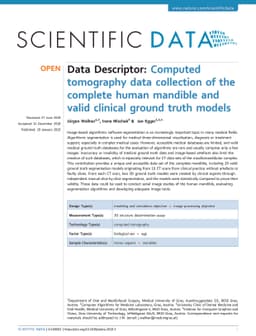 Computed tomography data collection of the complete human mandible and
  valid clinical ground truth models