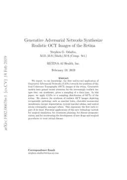 Generative Adversarial Networks Synthesize Realistic OCT Images of the
  Retina