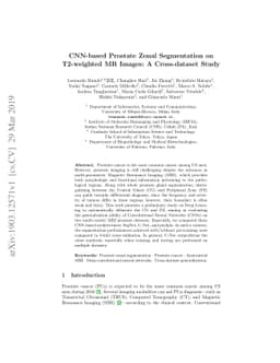 CNN-based Prostate Zonal Segmentation on T2-weighted MR Images: A
  Cross-dataset Study