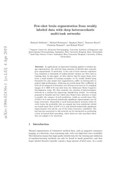 Few-shot brain segmentation from weakly labeled data with deep
  heteroscedastic multi-task networks