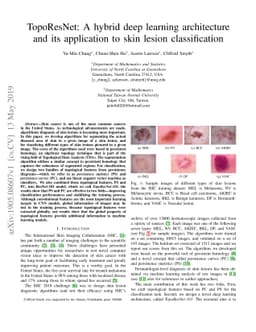 TopoResNet: A hybrid deep learning architecture and its application to
  skin lesion classification