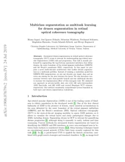 Multiclass segmentation as multitask learning for drusen segmentation in
  retinal optical coherence tomography