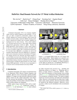 DuDoNet: Dual Domain Network for CT Metal Artifact Reduction