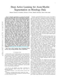 Deep Active Learning for Axon-Myelin Segmentation on Histology Data