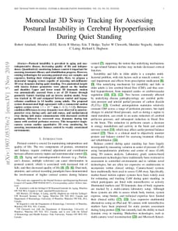 Monocular 3D Sway Tracking for Assessing Postural Instability in
  Cerebral Hypoperfusion During Quiet Standing