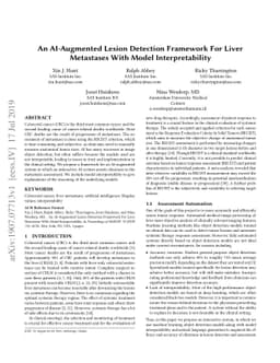 An AI-Augmented Lesion Detection Framework For Liver Metastases With
  Model Interpretability