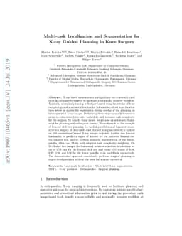 Multi-task Localization and Segmentation for X-ray Guided Planning in
  Knee Surgery