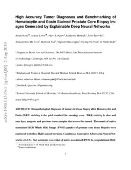 High Accuracy Tumor Diagnoses and Benchmarking of Hematoxylin and Eosin
  Stained Prostate Core Biopsy Images Generated by Explainable Deep Neural
  Networks