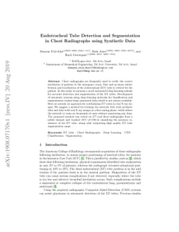 Endotracheal Tube Detection and Segmentation in Chest Radiographs using
  Synthetic Data