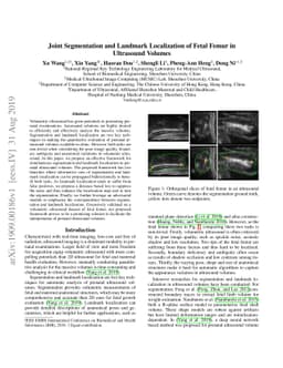 Joint Segmentation and Landmark Localization of Fetal Femur in
  Ultrasound Volumes