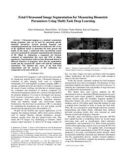 Fetal Ultrasound Image Segmentation for Measuring Biometric Parameters
  Using Multi-Task Deep Learning