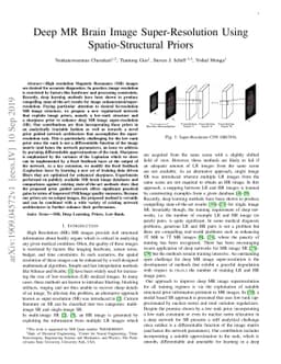 Deep MR Brain Image Super-Resolution Using Spatio-Structural Priors