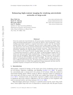 Enhancing high-content imaging for studying microtubule networks at
  large-scale