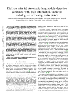 Did you miss it? Automatic lung nodule detection combined with gaze
  information improves radiologists' screening performance