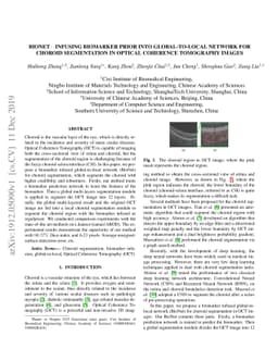 BioNet: Infusing Biomarker Prior into Global-to-Local Network for
  Choroid Segmentation in Optical Coherence Tomography Images