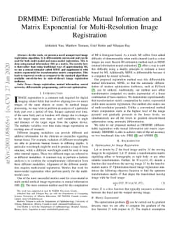 DRMIME: Differentiable Mutual Information and Matrix Exponential for
  Multi-Resolution Image Registration