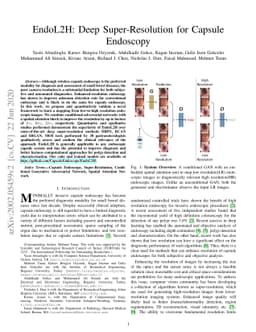 EndoL2H: Deep Super-Resolution for Capsule Endoscopy