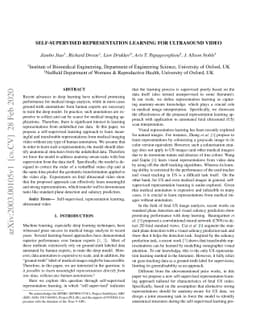 Self-supervised Representation Learning for Ultrasound Video
