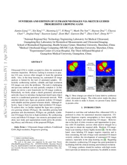 Synthesis and Edition of Ultrasound Images via Sketch Guided Progressive
  Growing GANs