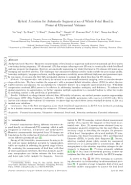 Hybrid Attention for Automatic Segmentation of Whole Fetal Head in
  Prenatal Ultrasound Volumes