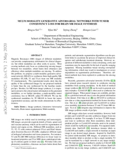 Multi-Modality Generative Adversarial Networks with Tumor Consistency
  Loss for Brain MR Image Synthesis