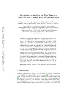 Keypoints Localization for Joint Vertebra Detection and Fracture
  Severity Quantification