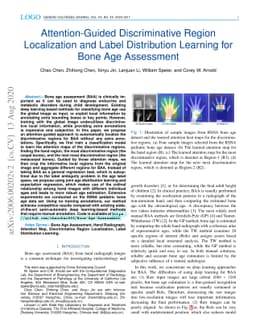 Attention-Guided Discriminative Region Localization and Label
  Distribution Learning for Bone Age Assessment