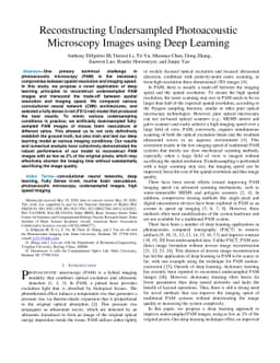 Reconstructing undersampled photoacoustic microscopy images using deep
  learning