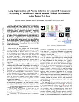 Lung Segmentation and Nodule Detection in Computed Tomography Scan using
  a Convolutional Neural Network Trained Adversarially using Turing Test Loss