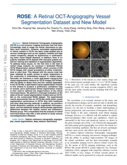 ROSE: A Retinal OCT-Angiography Vessel Segmentation Dataset and New
  Model