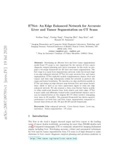 E$^2$Net: An Edge Enhanced Network for Accurate Liver and Tumor
  Segmentation on CT Scans