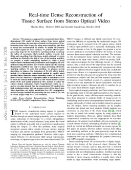 Real-time Dense Reconstruction of Tissue Surface from Stereo Optical
  Video