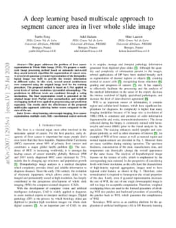 A deep learning based multiscale approach to segment cancer area in
  liver whole slide image