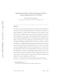 Implanting Synthetic Lesions for Improving Liver Lesion Segmentation in
  CT Exams