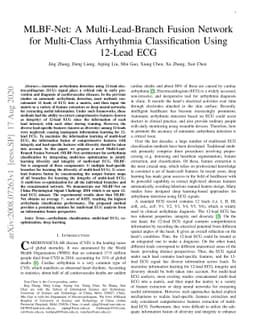 MLBF-Net: A Multi-Lead-Branch Fusion Network for Multi-Class Arrhythmia
  Classification Using 12-Lead ECG